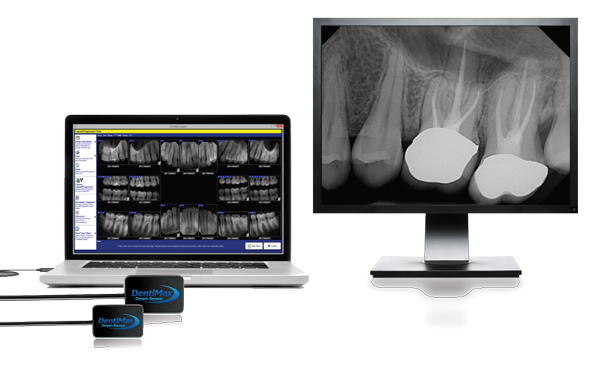 Picture of computer monitor with Dentimax Dental sensor